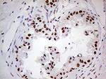 POLR2A Antibody in Immunohistochemistry (Paraffin) (IHC (P))