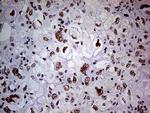 POLR2A Antibody in Immunohistochemistry (Paraffin) (IHC (P))