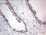 POLR2A Antibody in Immunohistochemistry (Paraffin) (IHC (P))