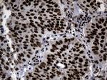 POLR2A Antibody in Immunohistochemistry (Paraffin) (IHC (P))