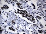 POLR2A Antibody in Immunohistochemistry (Paraffin) (IHC (P))