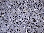 POLR2A Antibody in Immunohistochemistry (Paraffin) (IHC (P))