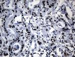 POLR2A Antibody in Immunohistochemistry (Paraffin) (IHC (P))