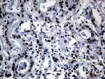 POLR2A Antibody in Immunohistochemistry (Paraffin) (IHC (P))