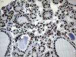 POLR2A Antibody in Immunohistochemistry (Paraffin) (IHC (P))