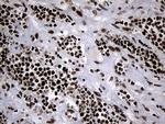 POLR2A Antibody in Immunohistochemistry (Paraffin) (IHC (P))