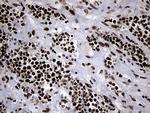 POLR2A Antibody in Immunohistochemistry (Paraffin) (IHC (P))