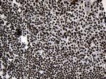 POLR2A Antibody in Immunohistochemistry (Paraffin) (IHC (P))