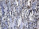 POLR2A Antibody in Immunohistochemistry (Paraffin) (IHC (P))