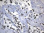 POLR2A Antibody in Immunohistochemistry (Paraffin) (IHC (P))