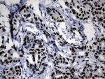 POLR2A Antibody in Immunohistochemistry (Paraffin) (IHC (P))