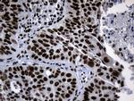 POLR2A Antibody in Immunohistochemistry (Paraffin) (IHC (P))