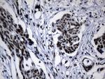 POLR2A Antibody in Immunohistochemistry (Paraffin) (IHC (P))