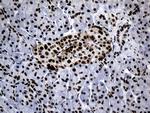 POLR2A Antibody in Immunohistochemistry (Paraffin) (IHC (P))