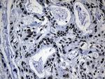 POLR2A Antibody in Immunohistochemistry (Paraffin) (IHC (P))