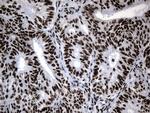 POLR2A Antibody in Immunohistochemistry (Paraffin) (IHC (P))