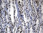 POLR2A Antibody in Immunohistochemistry (Paraffin) (IHC (P))