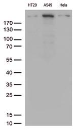 POLR2A Antibody in Western Blot (WB)