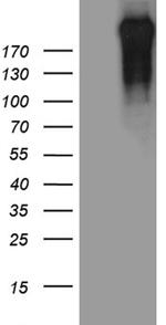 POLR2A Antibody in Western Blot (WB)