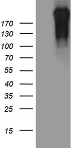 POLR2A Antibody in Western Blot (WB)