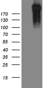 POLR2A Antibody in Western Blot (WB)