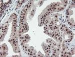 POLR2E Antibody in Immunohistochemistry (Paraffin) (IHC (P))