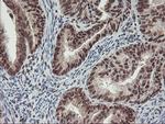 POLR2E Antibody in Immunohistochemistry (Paraffin) (IHC (P))