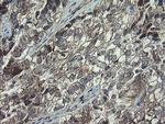 POLR3C Antibody in Immunohistochemistry (Paraffin) (IHC (P))