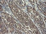 POLR3C Antibody in Immunohistochemistry (Paraffin) (IHC (P))