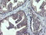 POLR3C Antibody in Immunohistochemistry (Paraffin) (IHC (P))