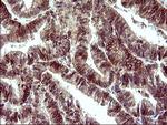 POLR3GL Antibody in Immunohistochemistry (Paraffin) (IHC (P))