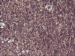 POLR3GL Antibody in Immunohistochemistry (Paraffin) (IHC (P))