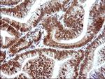 POLR3GL Antibody in Immunohistochemistry (Paraffin) (IHC (P))