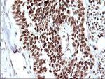 POLR3GL Antibody in Immunohistochemistry (Paraffin) (IHC (P))