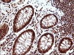 POLR3GL Antibody in Immunohistochemistry (Paraffin) (IHC (P))