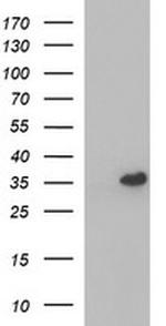 POLR3GL Antibody in Western Blot (WB)