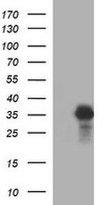 POMC Antibody in Western Blot (WB)