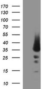 POMC Antibody in Western Blot (WB)