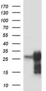 POMC Antibody in Western Blot (WB)