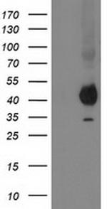 PON1 Antibody in Western Blot (WB)