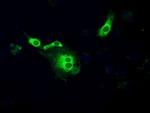 POR Antibody in Immunocytochemistry (ICC/IF)