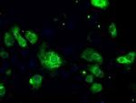 POR Antibody in Immunocytochemistry (ICC/IF)