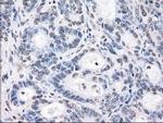 POR Antibody in Immunohistochemistry (Paraffin) (IHC (P))