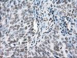 POR Antibody in Immunohistochemistry (Paraffin) (IHC (P))