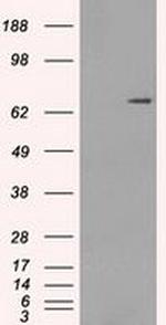 POR Antibody in Western Blot (WB)