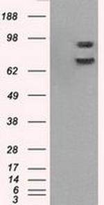 POR Antibody in Western Blot (WB)