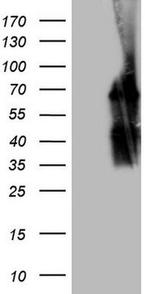 POTEG Antibody in Western Blot (WB)