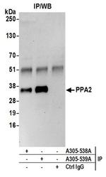 PPA2 Antibody in Western Blot (WB)