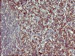 PPAP2A Antibody in Immunohistochemistry (Paraffin) (IHC (P))