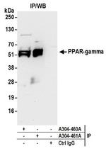PPAR-gamma Antibody in Western Blot (WB)